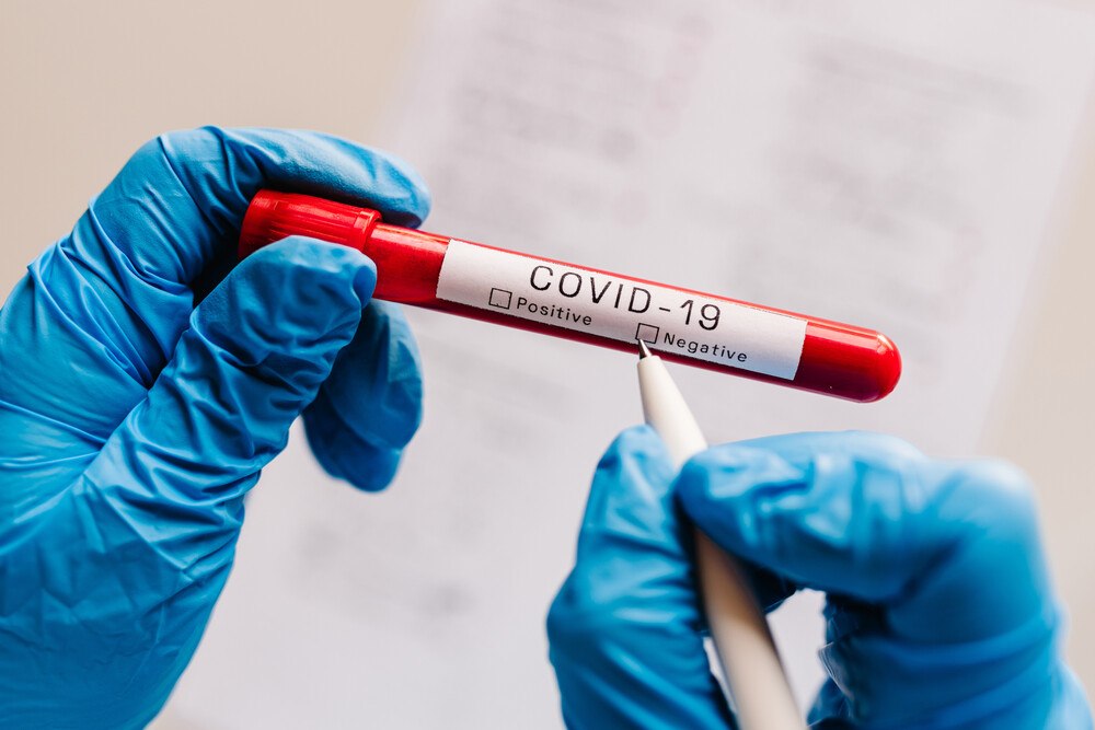 Rund 115.000 Corona-Tests gab es in den Beherbergungsbetrieben. Weniger als geplant. Nun soll auch die Gastronomie die Möglichkeit der Gratistests eröffnet werden.
© getty images Rund 115.000 Corona-Tests gab es in den Beherbergungsbetrieben. Weniger als geplant. Nun soll auch die Gastronomie die Möglichkeit der Gratistests eröffnet werden.
